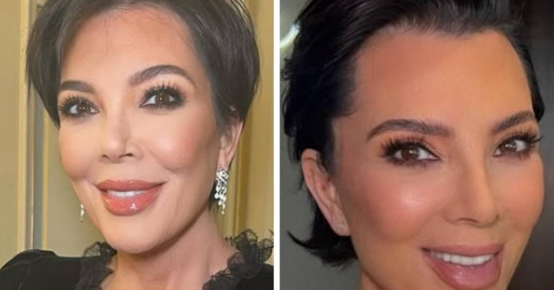 O que está por trás do ‘rejuvenescimento’ de Kris Jenner