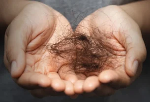 Tratamentos estéticos para alopecia: o que donos de clínicas precisam saber