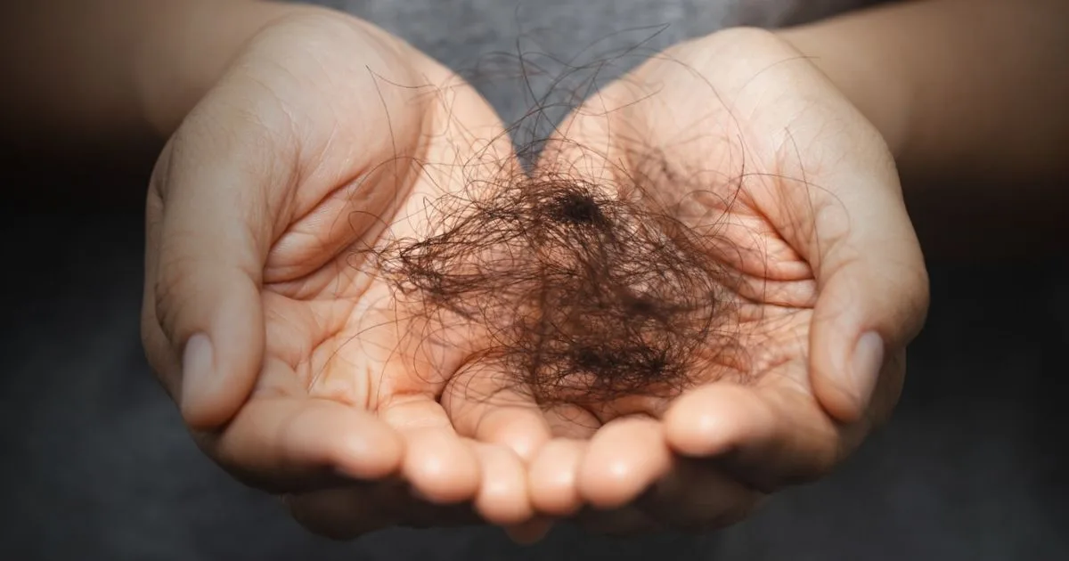 Tratamentos estéticos para alopecia: o que donos de clínicas precisam saber