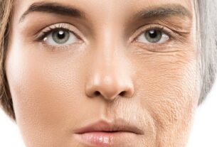 4 truques para evitar o envelhecimento precoce da pele