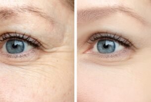 Como evitar rugas e outros problemas na região dos olhos?